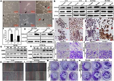 High Migration and Invasion Ability of PGCCs and Their Daughter Cells Associated With the Nuclear Localization of S100A10 Modified by SUMOylation